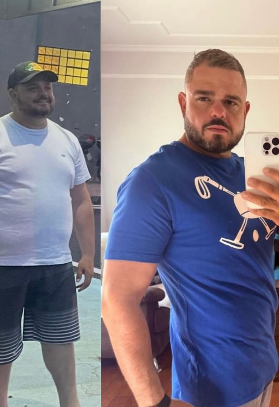 Resultado Slim Fire - antes e depois